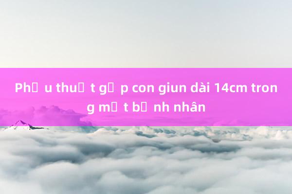 Phẫu thuật gắp con giun dài 14cm trong mắt bệnh nhân